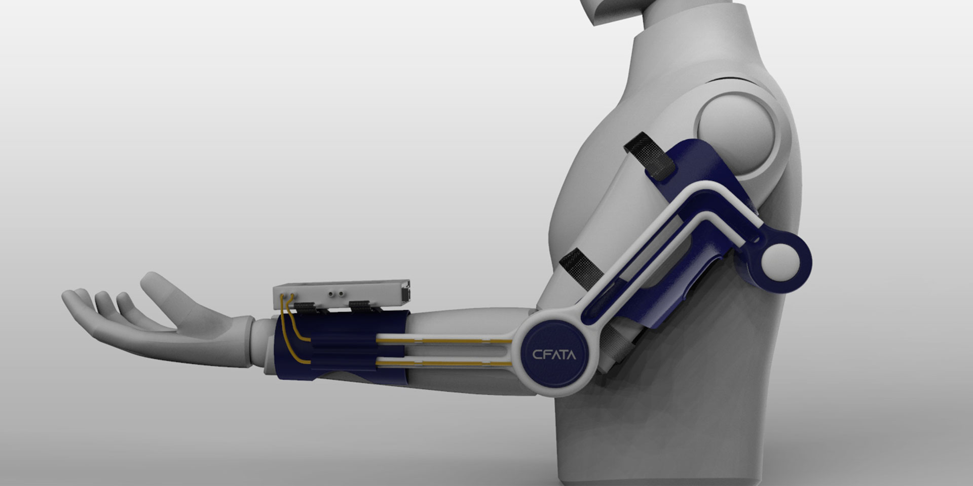 Imagen de rehabilitación de brazo